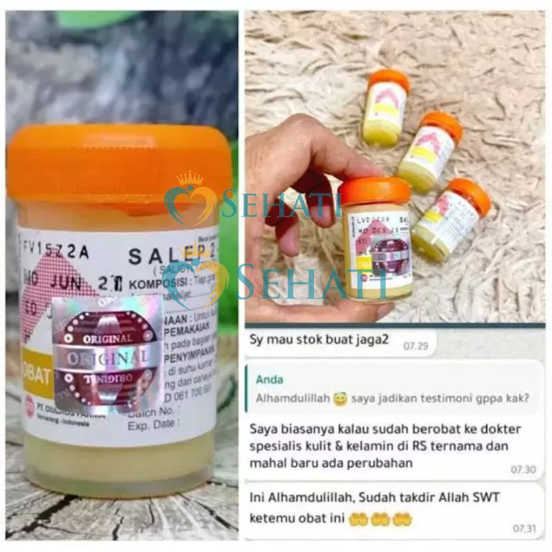 Salep Zwafel 24 Original Obat Jerawat Kadas Gatal Selangkangan Jamur Kudis Kurap Alergi Eksim Panu Skabies Ruam BPOM