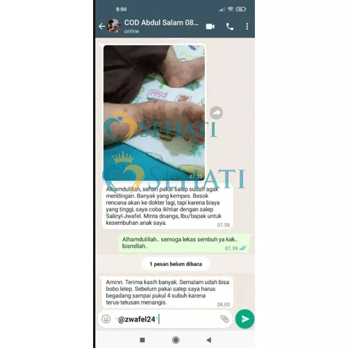 BPOM Salep Gatal Zwafel 24 Orginal Obat Gatel Selangkangan Skabies Eksim Biang Keringat Scabies