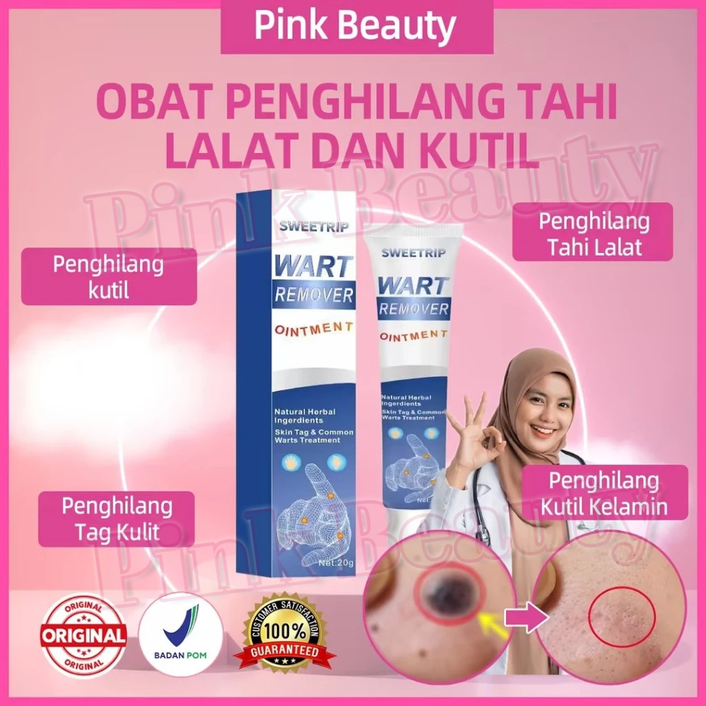 SWEETRIP Obat Penghilang Kutil Penghilang Tahi Lalat Dan Kutil Obat Penghilang tahi lalat dan kutil 