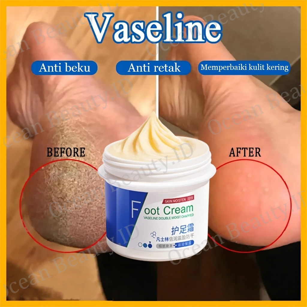 Vaseline kaki pecah dan kering Foot cream Obat kaki pecah Pelembab kaki kering dan pecah Penghalus k