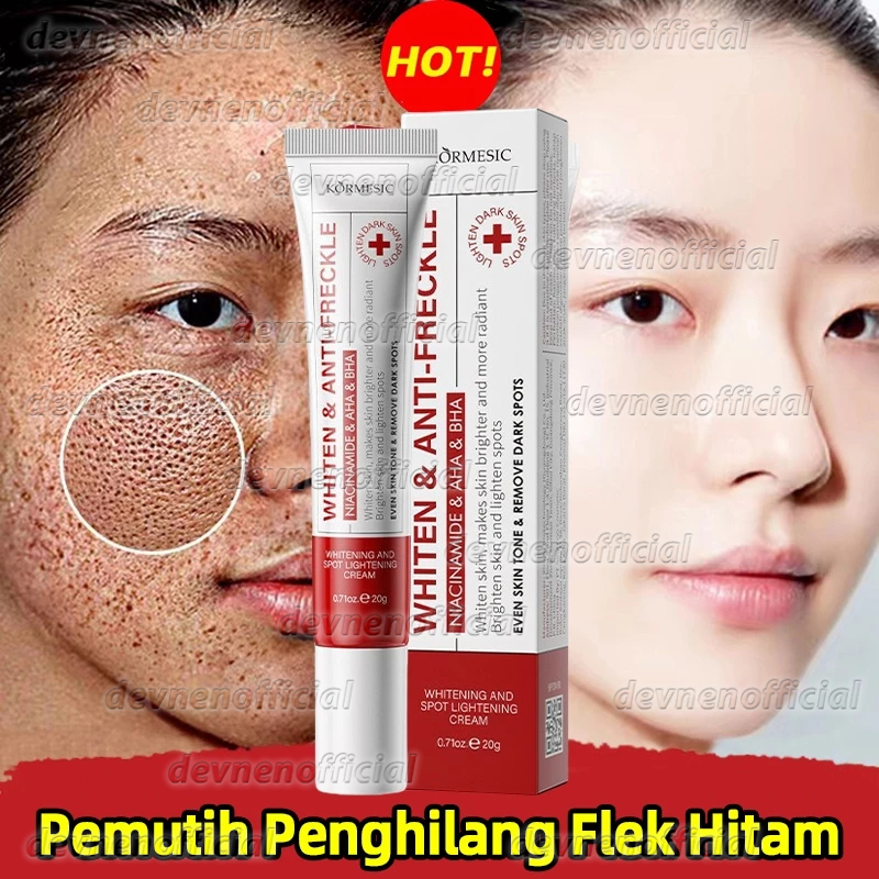 Cream Flek Hitam Membandel BPOM Cream Siang Malam Glowing Retinol Cream 20g Cream Penghilang Flek Hi