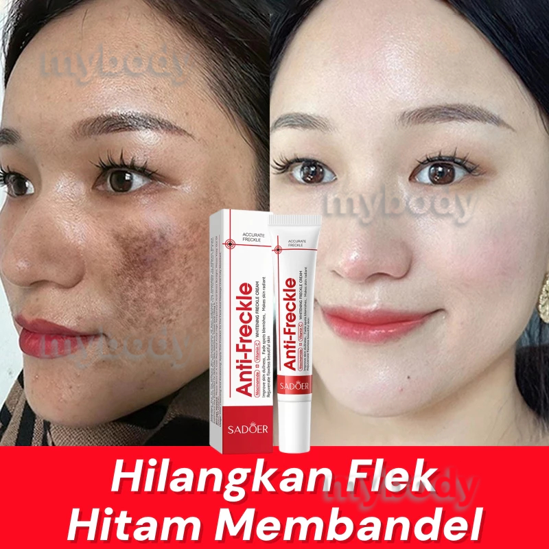 Niacinamide penghilang Flek Hitam Cream 20g Krim Pemutih anti bintik Krim pemutih wajah Krim bintik 