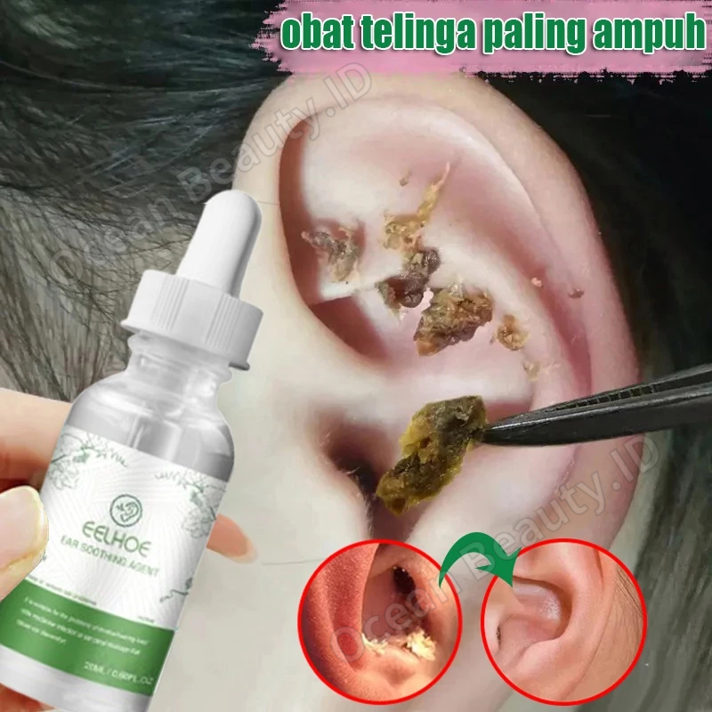 Obat Tetes Telinga Pembersih Telinga Bayi Obat Sakit Telinga Pembersih Kotoran Telinga Obat Telinga 
