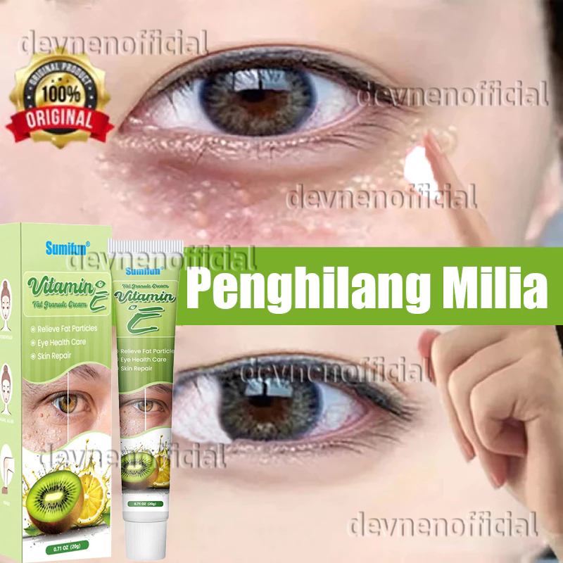 krim penghilang milia syringoma xanthelasma butiran lemak sekitar mata Milia remover cream 20g obat 
