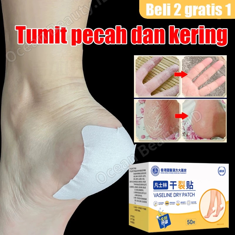 Untuk Kaki Pecah Dan Kering Koyo 50pcs Obat kaki pecah Penghalus Kaki Kasar Dan Pecah Kaki Kering Da
