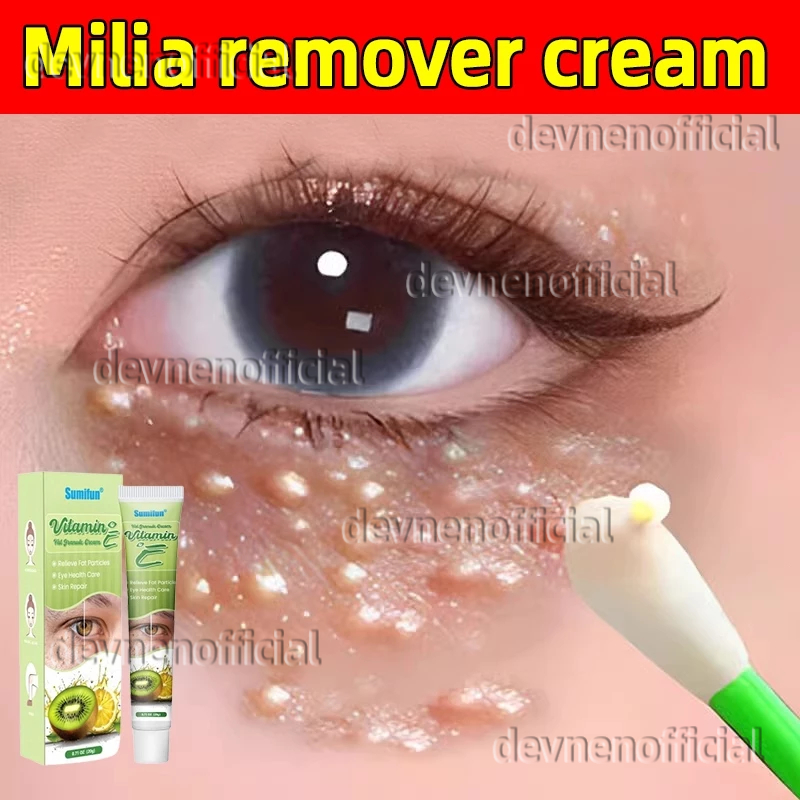 SHVA. krim penghilang milia syringoma xanthelasma butiran lemak sekitar mata Milia remover cream 20g