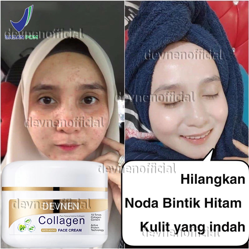 DEVNEN Collagen Cream Siang Malam Retinol Cream Anti Aging Perbaikan Retinol Night Cream Pemutih