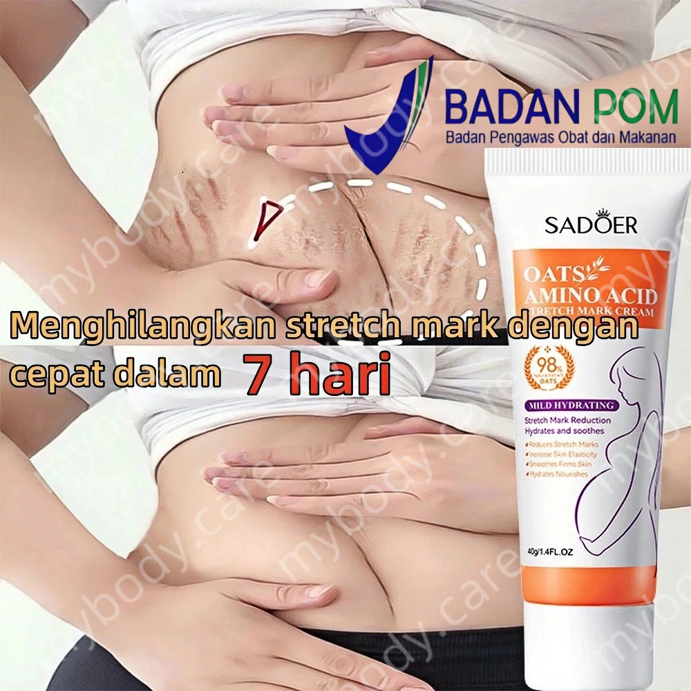 Penghilang Bekas Luka Krim Stretch Mark Krim Stretch Mark Cream Krim Penghilang Stretch Mark Krim
