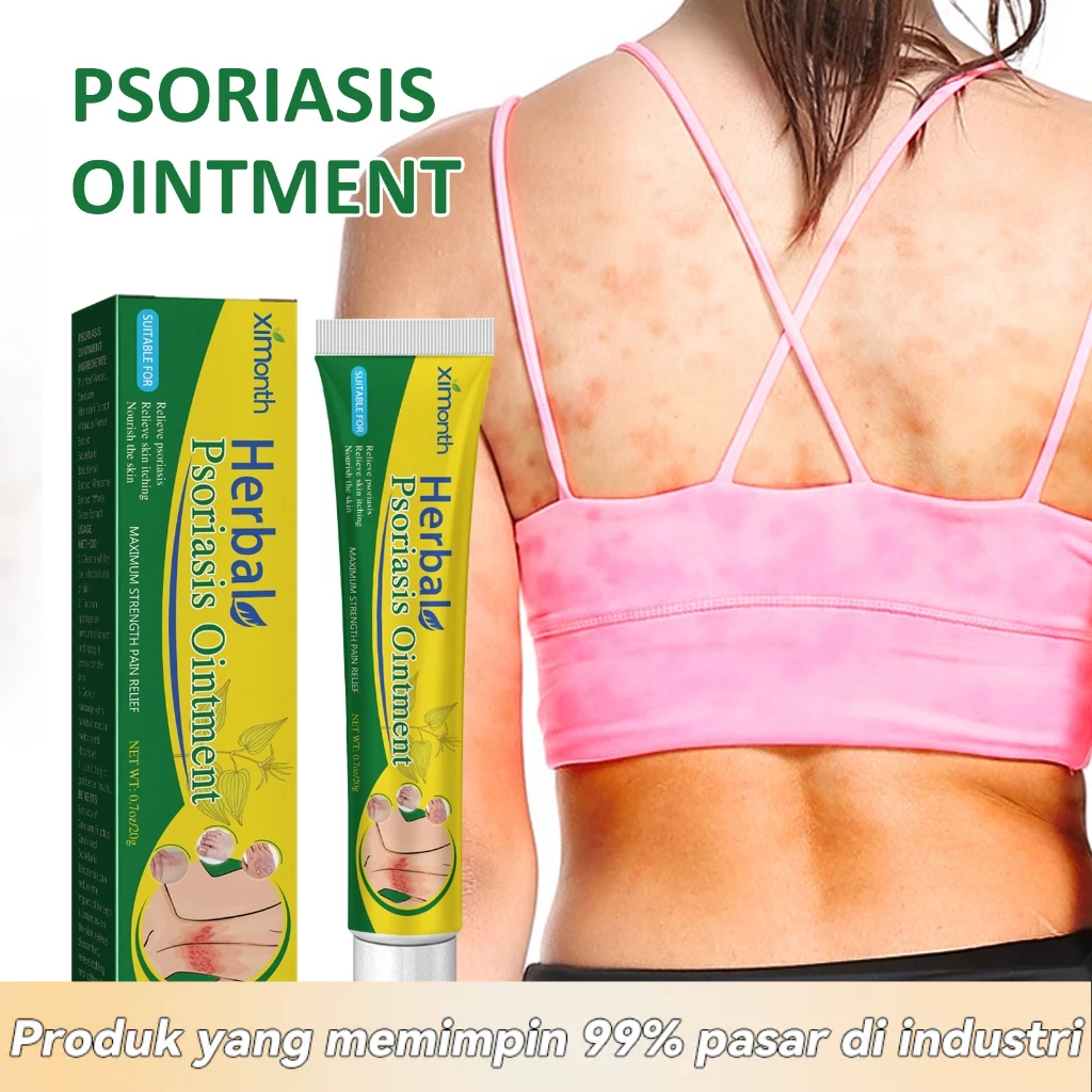 XiMonth Krim Psoriasis & Eksim - Salep Obat Gatal Kulit, Pereda Kemerahan & Gatal pada Tangan Kaki, 