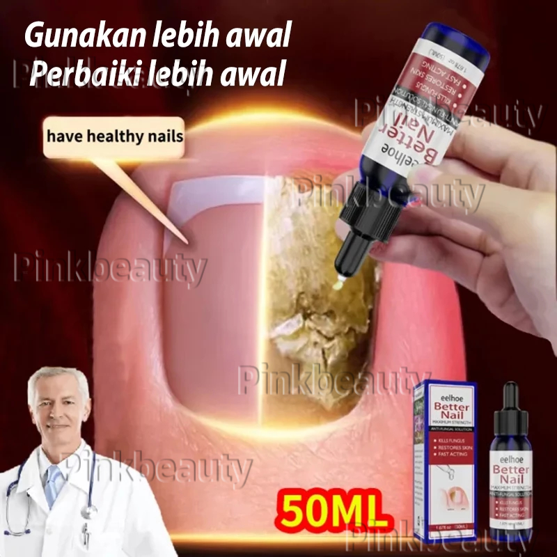 Obat Jamur Kuku Obat kuku jamur dan rusak Nail Repair Essence Serum Memperbaiki Kuku Rusak Penghilan