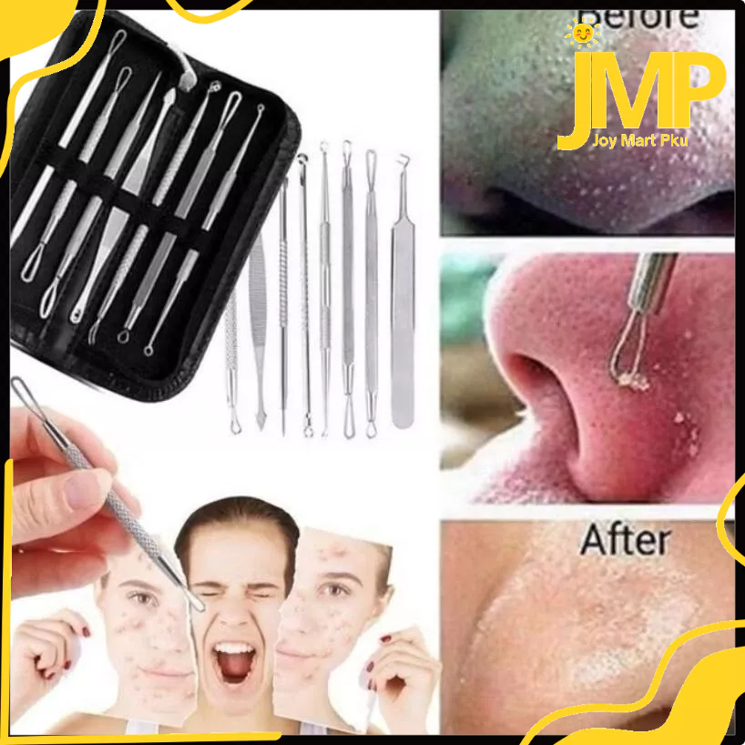 JMP - Alat Pencet Komedo / Pinset Pembersih Blackhead / Pinset Jepit Komedo / Penjepit Komedo Acne F