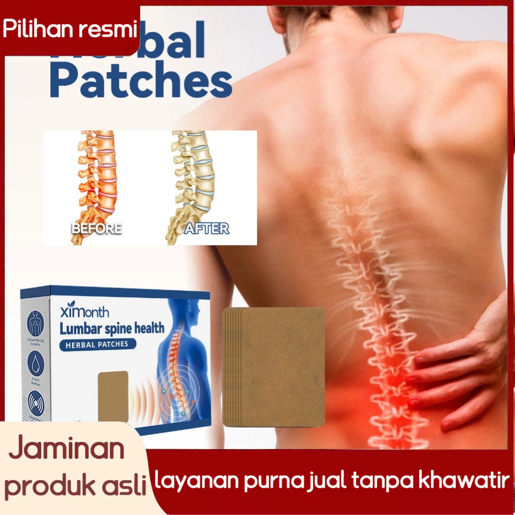 Ximonth Koyo Pereda Nyeri Sendi & Tulang - Obat Sakit Punggung, Leher Kaku, Lutut [12 Koyo] | Terapi