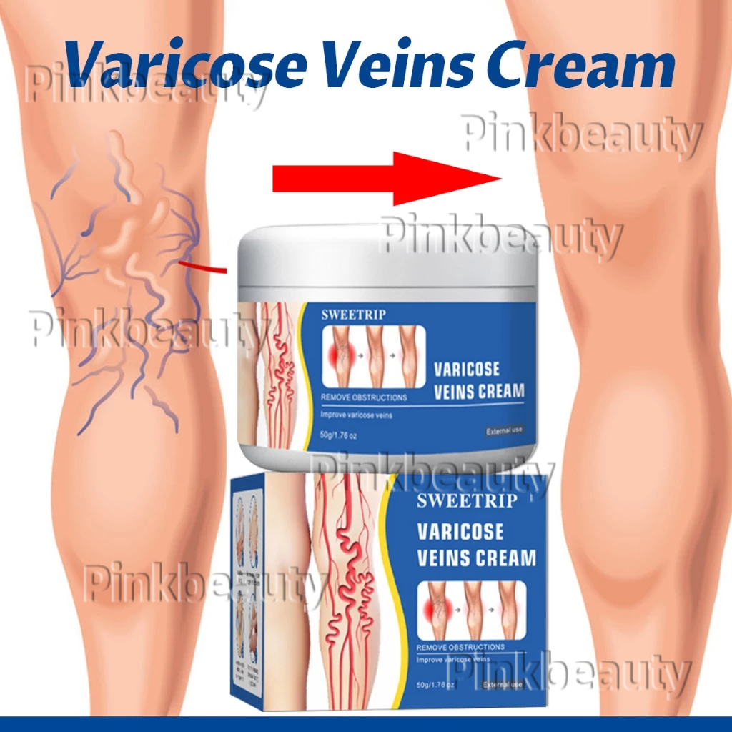 SWEETRIP Varicose Veins Cream Obat Varises Di Kaki Dan Betis Ampuh Salep Varises 50g salep labalaba 