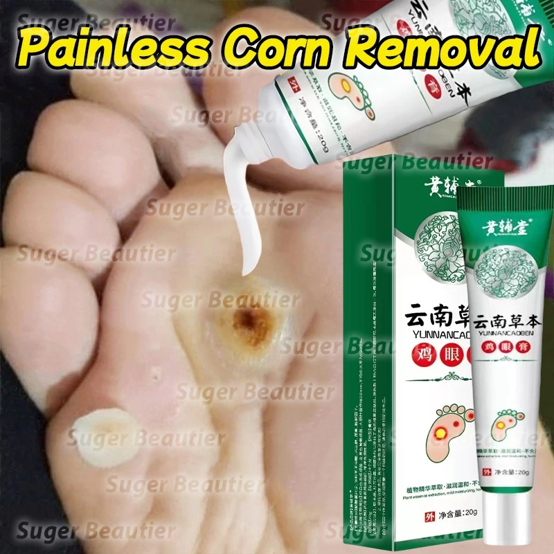 Obat Mata Ikan Obat Kutil Kapalan Mata Ikan Kaki 20g Kaki Ampuh Plester Penghilang Kutil Kapalan Mat