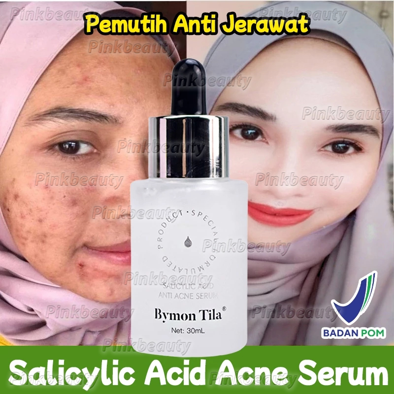 Salicylic Acid Acne Essence BPOM 30ML Serum Jerawat Acnes Penghilang Jerawat dan Bekas Jerawat Salep