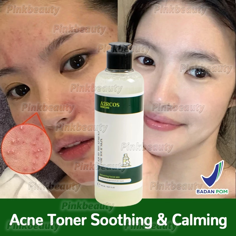 Acne Toner Soothing & Calming BPOM 200ml A2RCOS Liquid Treatment For Your Skin Toner Kulit Jerawat B