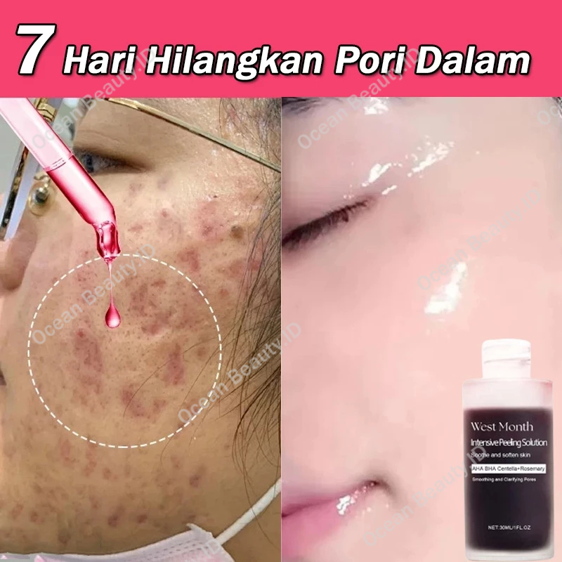 Intensive Peeling Solution Serum Mencerahkan Wajah Serum Eksfoliasi Wajah Serum anti aging 30ML Peng