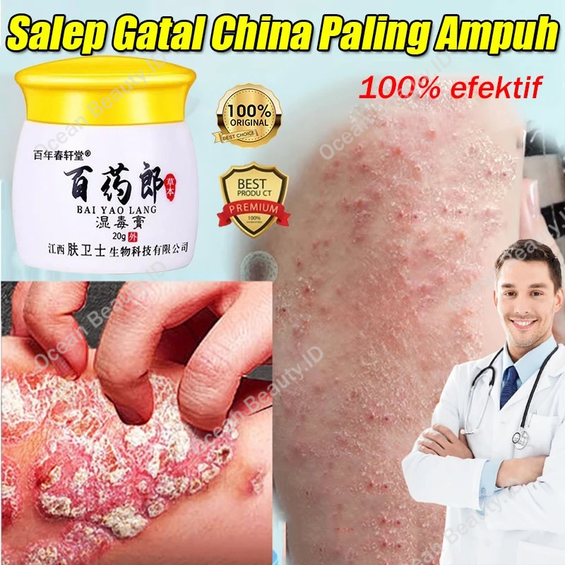 Salep Eksim Kering Dan Gatal Salep Gatal Selangkangan Obat Jamur Kulit Obat Eksim Salep Alergi Kulit