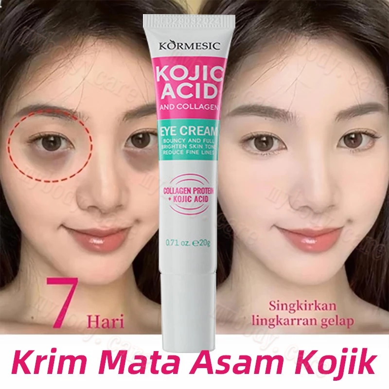 KOJIC ACID EYE CREAM 20gr Menghilangkan Kantung Mata Dengan Cepat Krim mata anti kerut anti penuaan 