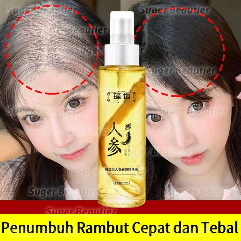 Ginseng Hair Essence oill Hair Tonic Perawatan Rambut Dan Pertumbuhan Rambut 120ml Hair Serum Penumb