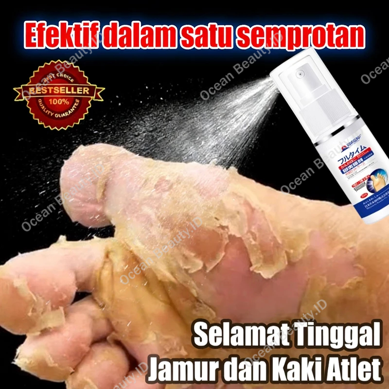Obat Gatal Paling Ampuh Obat Kaki Rayapan Penghilang Bau Kaki Obat Jamur Kaki Salep Kaki Rayapan Dan