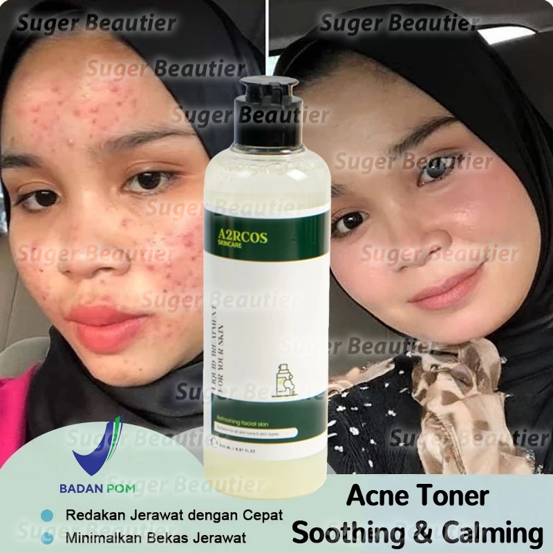 Acne Toner Soothing & Calming 200ml BPOM A2RCOS Liquid Treatment For Your Skin Toner Kulit Jerawat B