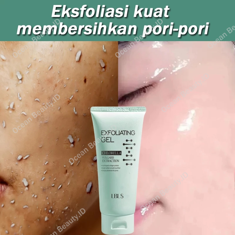 Exfoliating Gel Wajah Eksfoliasi Wajah Peeling Gel Exfoliating Pengangkat Komedo Paling Ampuh Pengec