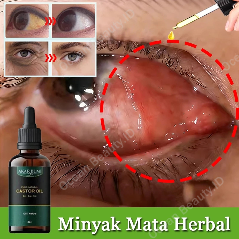 Eye Serum Sakit Mata Perawatan Mata Lelah Obat Mata Merah Tetes Mata Minus Paling Ampuh Penghilang M
