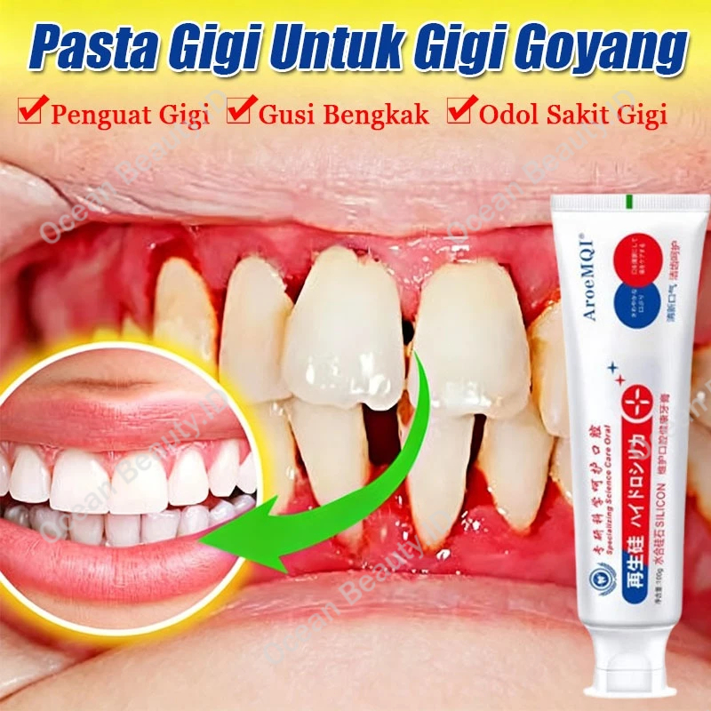 Obat Gigi Goyang Pasta Gigi Penguat Gigi Goyang Obat Gusi Bengkak Penumbuh Gigi Permanen Gum Care To