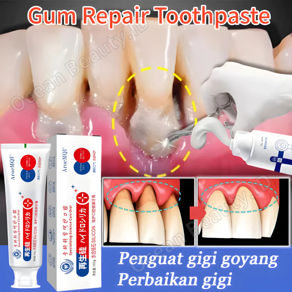Obat Gigi Goyang Pasta Gigi Penguat Gigi Goyang Obat Gusi Bengkak Penumbuh Gigi Permanen Gum Care To