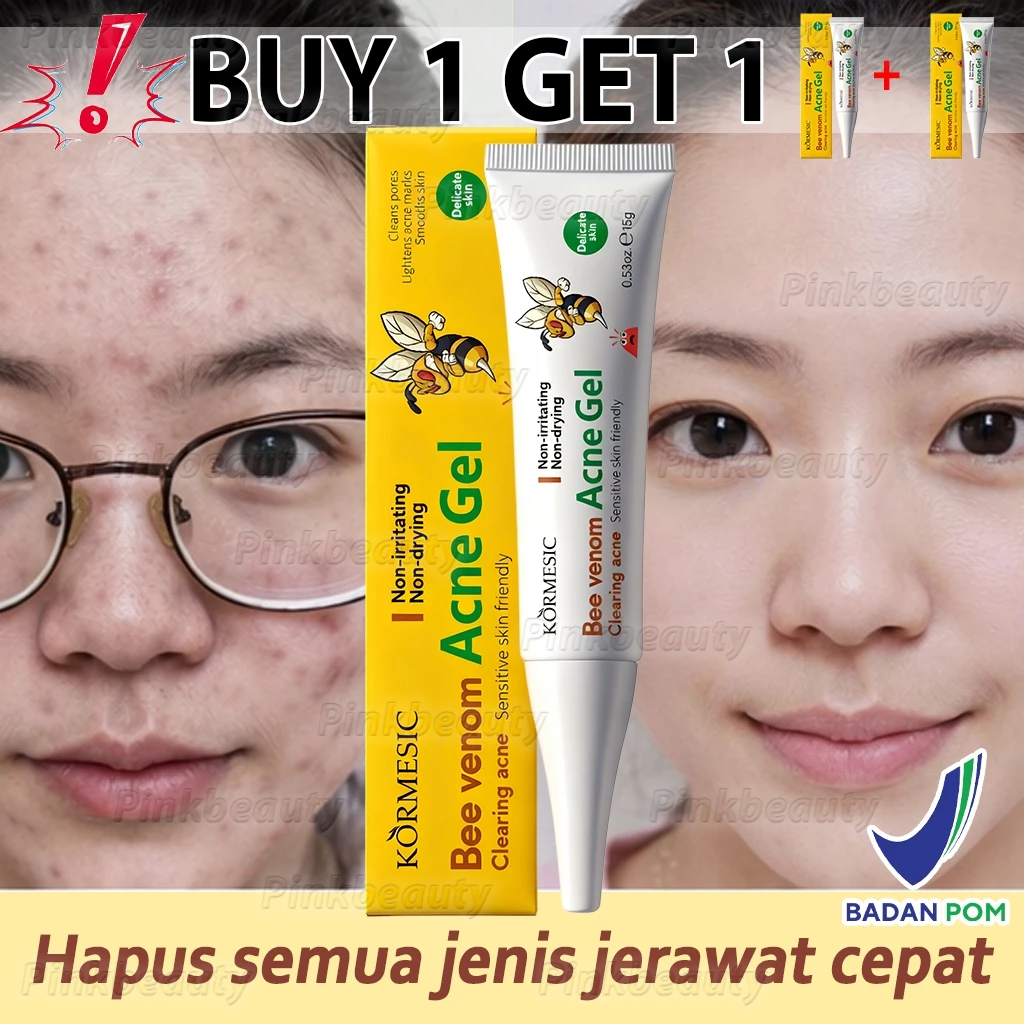BPOM Ampuh Cream Penghilang Jerawat Herbal 15gr Bee Venom Acne Gel Penghilang Bekas Jerawat Bopeng O