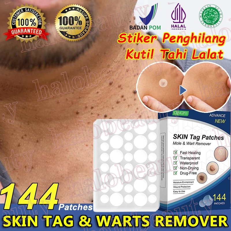 skin tag patches 144pcs Stiker Penghilang Kutil Tahi Lalat Wart Removal Patch tanpa rasa sakit Pengh