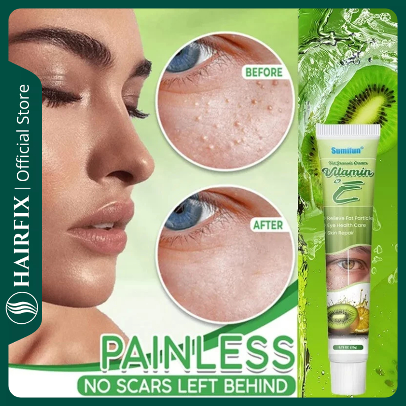 VE Fat Particles Eye Cream 20g – Krim Penghilang Milia, Syringoma & Lemak di Bawah Mata, Melembapkan
