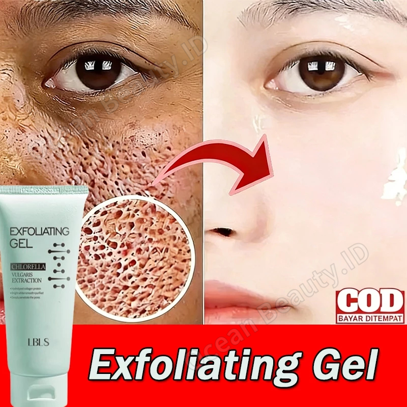 Exfoliating Gel Wajah Eksfoliasi Wajah Peeling Gel Exfoliating Pengangkat Komedo Paling Ampuh Pengec