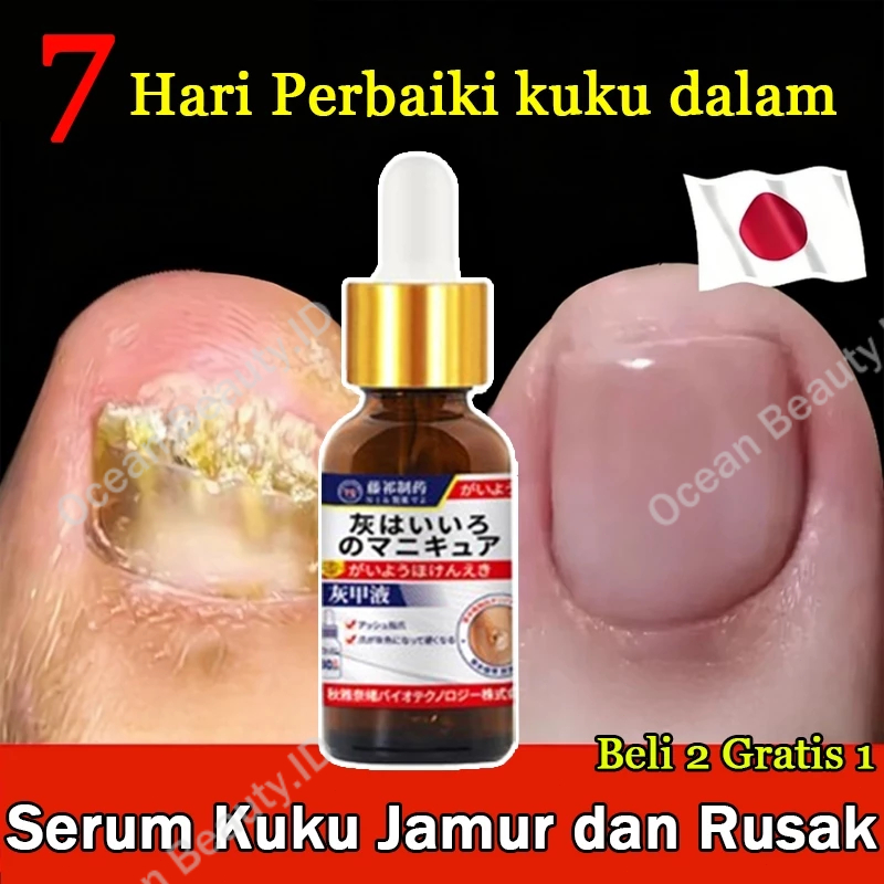Obat Jamur Kuku Serum Kuku Jamur dan Rusak Obat cantengan Perawatan Kuku Obat Kuku Berjamur Vitamin 