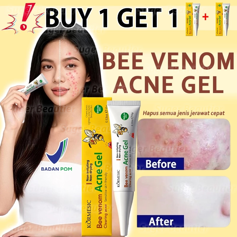 Ampuh Cream Penghilang Jerawat Herbal 15gr Bee Venom Acne Gel Penghilang Bekas Jerawat Bopeng Obat T