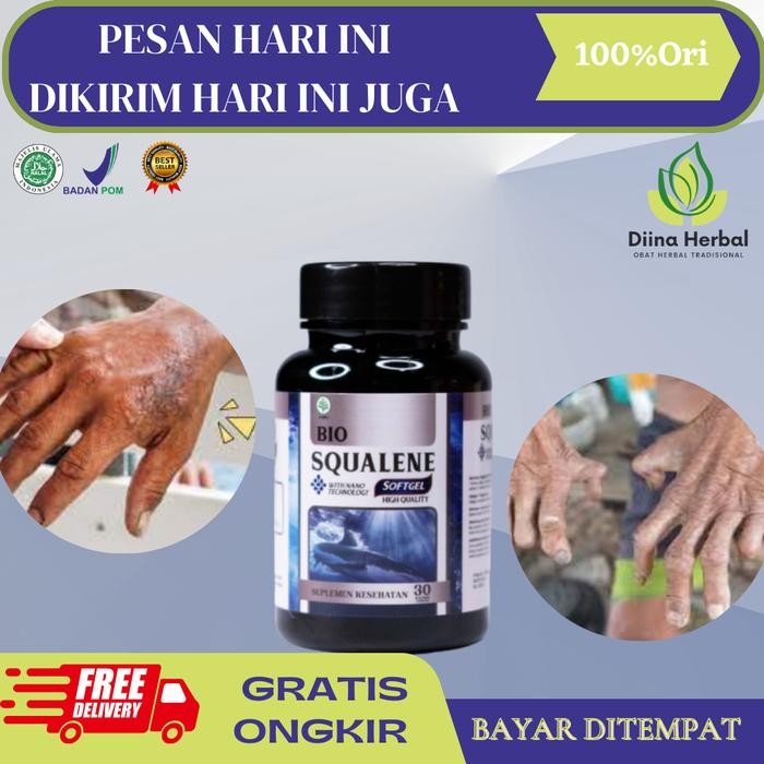 Penyakit Kusta Kering, Herbal Untuk Penyakit Kusta, Kusta Lepra, Kusta Basah, Kusta Kering Mati