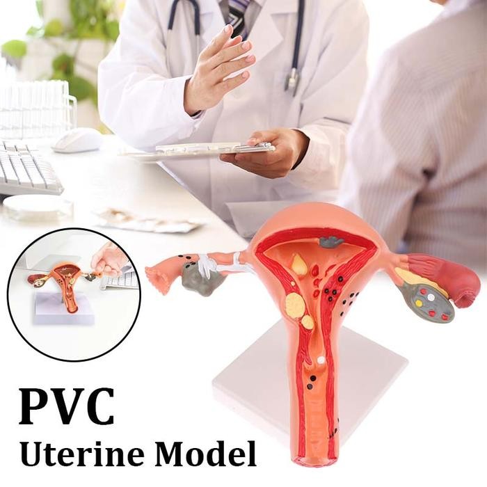 1Set Uterus Anatomical Model Patologis Uterus Ovarium Alat Peraga Uterus Uterus Ovary Anatomical