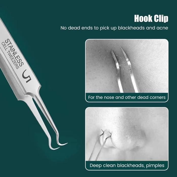 NEW!!! MAANGE 3Pcs / Set Pinset Komedo Blackhead Alat Extractor 1573