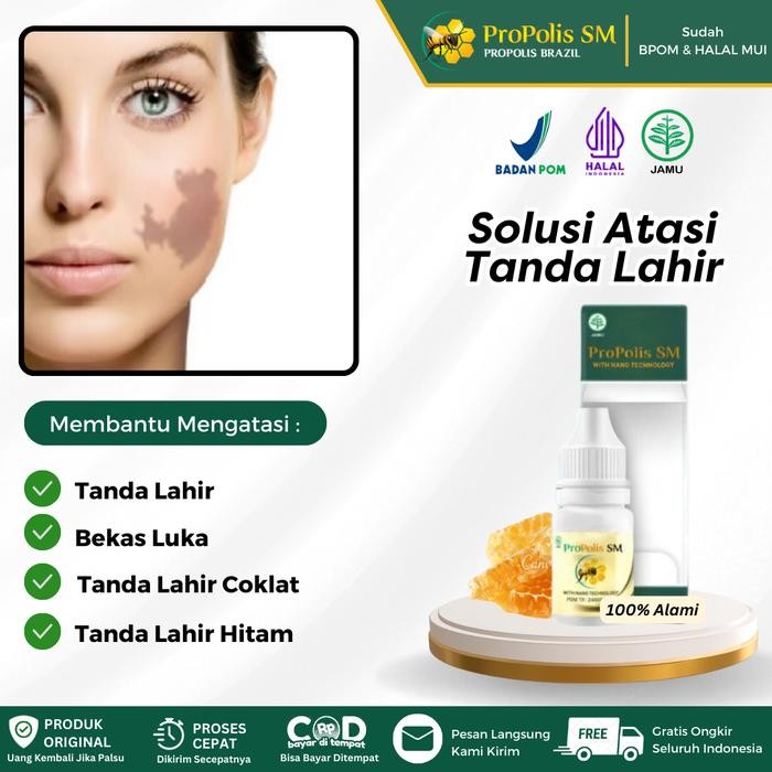 Salep Oles Penghilang Tanda Lahir, Tanda Lahir Coklat / Hitam di Muka, Bopeng di Wajah Atasi Dengan