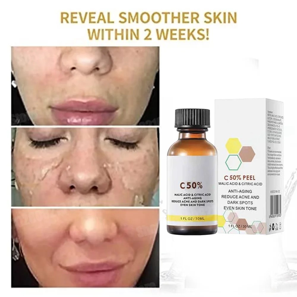 IMPORT Salicylic Acid Face Facial Peel Neutraliser Face Deep At Home Chemical Peel Exfoliate Refine