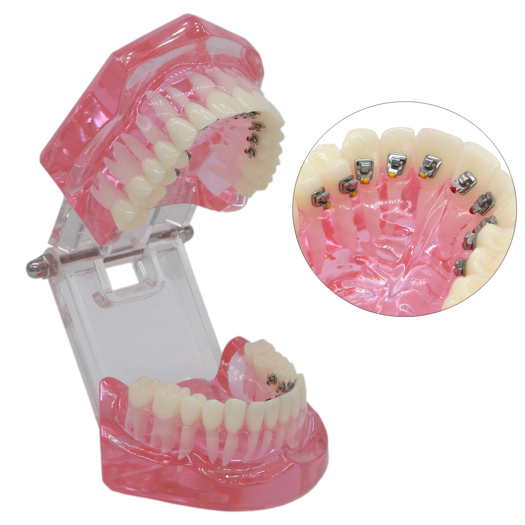 Dental Teaching Teeth Model Typodont Ortho Implant Practice Demo M3004