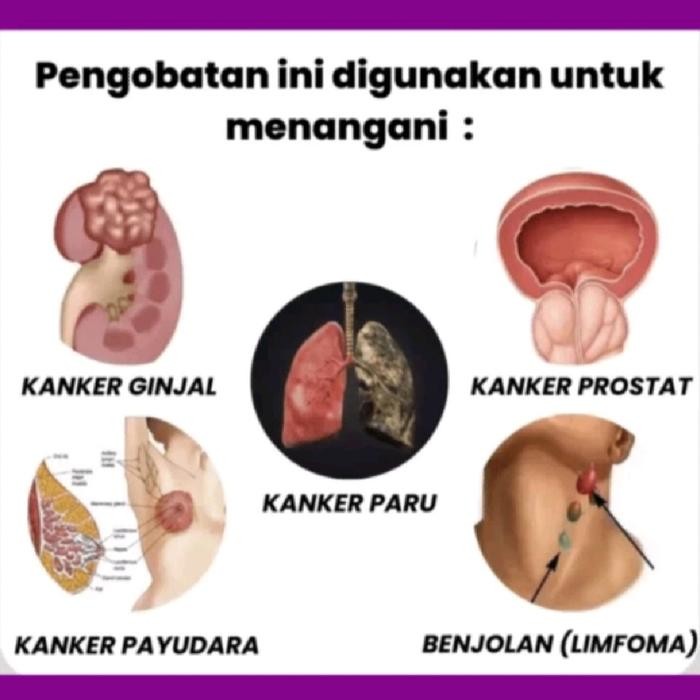 

ACE MAX MAXS MAX'S ACEMAX ACEMAXS ACEMAX'S JUS KULIT MANGGIS+DAUN SIRSAK