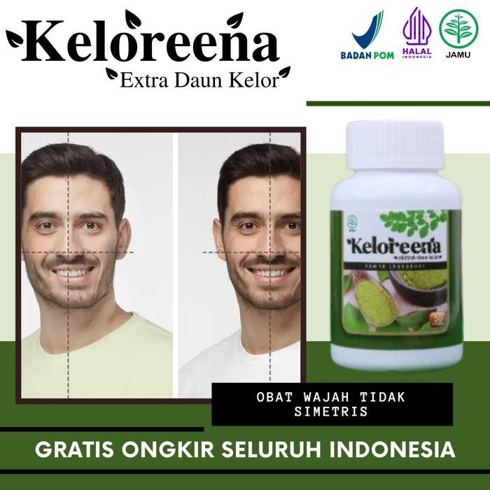 Keloreena Mengatasi Wajah Tidak Simetris, Bibir Miring, Saraf Wajah, Bells Palsy, Rahang Tidak