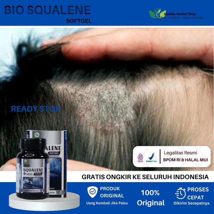 Bio Squalene Vitamin Jamur di Kulit Kepala, Gatal gatal di Kepala, Kulit Kepala Berkerak, Ketombe