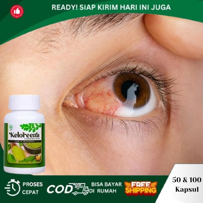 Penghilang Mata Berlemak, Mata Berlemak, Pterigium Keloreena Ekstra Daun Kelor Terlaris