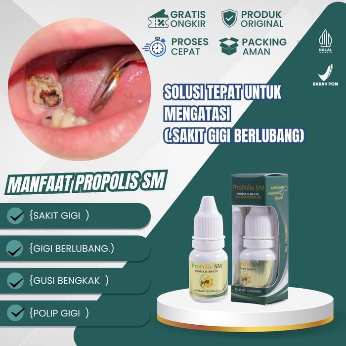 Propolis Sm Untuk Sakit Gigi Berlubang Polip gigi Gusi Bengkak dan Berdarah