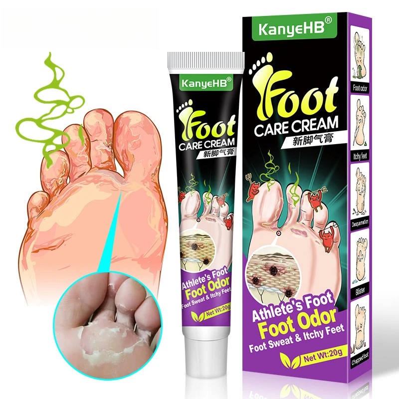 Foot Beriberi Treatment Cream For Foot Care Tools Foot Ointment Feet Odor Care Fungus Athlete Care