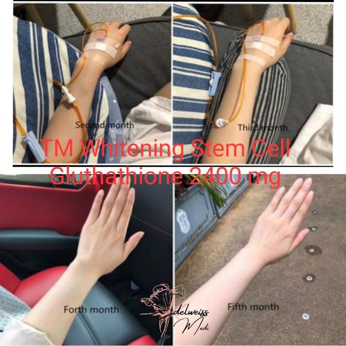 Tm Infs Whitening Glutathione 2400Mg