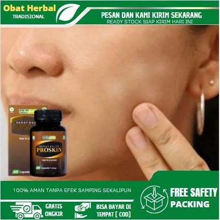 Perawatan Panu Di Wajah, Bercak Putih Di Kulit, Kadas, Kudis, kurap, Balas Bogo, Penghilang Panu,